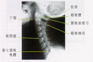 图一