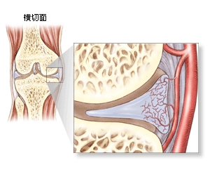 图三